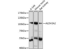 Western blot analysis of extracts of various cell lines, using  Rabbit pAb  at 1:1000 dilution. (ALDH3A2 anticorps  (AA 250-320))