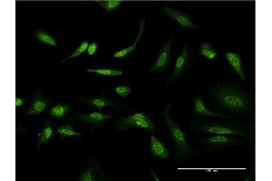 Immunofluorescence of monoclonal antibody to ID1 on HeLa cell. (ID1 anticorps  (AA 47-155))