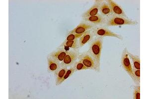 Immunocytochemistry analysis of Hela cells using ABIN7139188 at dilution of 1:100