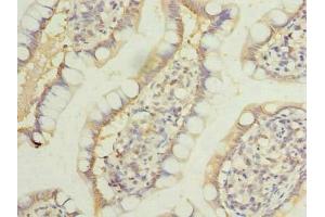 Immunohistochemistry of paraffin-embedded human small intestine tissue using ABIN7158166 at dilution of 1:100 (LRRC39 anticorps  (AA 1-335))