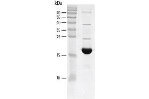 Recombinant TRIM24 (862-980) protein gel.