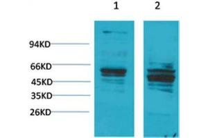 Western Blot (WB) analysis of 1) Mouse Brain Tissue, 2) Rat Brain Tissue with Bombesin Receptor 2 Rabbit Polyclonal Antibody diluted at 1:2000. (Bombesin Receptor 2 anticorps)