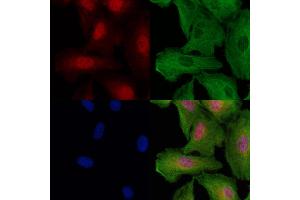 ABIN6257056 and ABIN6274986 staining  cells by IF/ICC.