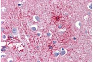 Human Brain, cortex: Formalin-Fixed, Paraffin-Embedded (FFPE)