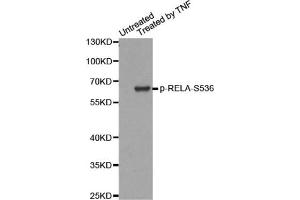 Western blot analysis of extracts from HepG2 cells, using Phospho-RELA-S536 antibody. (NF-kB p65 anticorps  (pSer536))