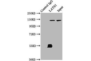 Immunoprecipitating LATS1 in K562 whole cell lysate Lane 1: Rabbit control IgG (1 μg) instead of ABIN7169059 in K562 whole cell lysate.