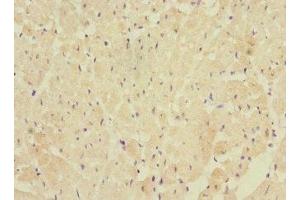 Immunohistochemistry of paraffin-embedded human heart tissue using ABIN7152439 at dilution of 1:100 (FBXO4 anticorps  (AA 201-500))