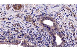 Detection of Bcl2L in Rat Uterus Tissue using Polyclonal Antibody to B-Cell CLL/Lymphoma 2 Like Protein (Bcl2L)