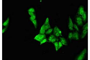 Immunofluorescent analysis of Hela cells using ABIN7161282 at dilution of 1:100 and Alexa Fluor 488-congugated AffiniPure Goat Anti-Rabbit IgG(H+L)
