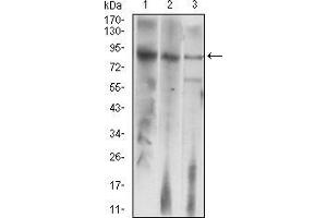 Western blot analysis using LHCGR mouse mAb against HepG2 (1), Jurkat (2), and SMMC-7721 (3) cell lysate. (LHCGR anticorps)