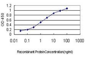Detection limit for recombinant GST tagged ERN1 is approximately 0. (ERN1 anticorps  (AA 401-500))