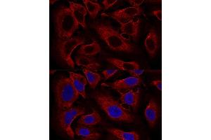 anti-ADP-Ribosylation Factor-Like 8B (ARL8B) (AA 127-186) antibody