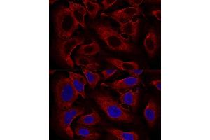 Confocal immunofluorescence analysis of U2OS cells using B Polyclonal Antibody (ABIN6131419, ABIN6137118, ABIN6137119 and ABIN6224820) at dilution of 1:100. (ARL8B anticorps  (AA 127-186))