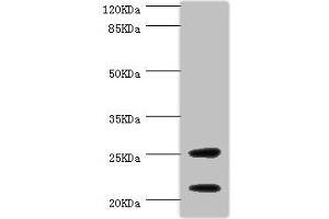 Western blot All lanes: CSRP3 antibody at 1 μg/mL + Mouse skeletal muscle tissue Secondary Goat polyclonal to rabbit IgG at 1/10000 dilution Predicted band size: 21 kDa Observed band size: 21, 25 kDa (CSRP3 anticorps  (AA 1-194))
