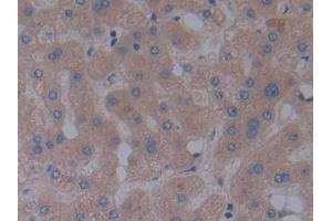 Detection of FBN1 in Human Liver Tissue using Polyclonal Antibody to Fibrillin 1 (FBN1)