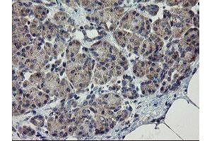 anti-rho GTPase Activating Protein 2 (ARHGAP2) antibody