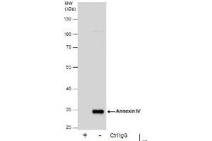 IP Image Immunoprecipitation of Annexin IV protein from HepG2 whole cell extracts using 5 μg of Annexin IV antibody, Western blot analysis was performed using Annexin IV antibody, EasyBlot anti-Rabbit IgG  was used as a secondary reagent. (Annexin IV anticorps)