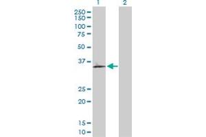 Western Blot analysis of OLR1 expression in transfected 293T cell line by OLR1 MaxPab polyclonal antibody. (OLR1 anticorps  (AA 1-273))