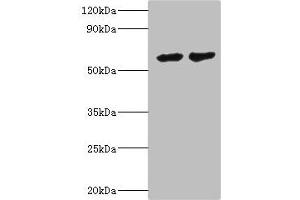 Western blot All lanes: CYP4F12 antibody at 6 μg/mL Lane 1: Mouse small intestine tissue Lane 2: Rat liver tissue Secondary Goat polyclonal to rabbit IgG at 1/10000 dilution Predicted band size: 61, 12 kDa Observed band size: 61 kDa