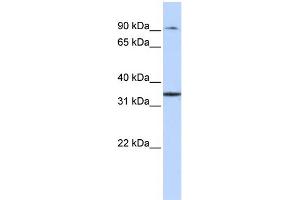 WB Suggested Anti-ZFP90 Antibody Titration: 0. (ZNF90 anticorps  (Middle Region))
