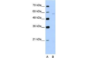 WB Suggested Anti-SLC22A7 Antibody Titration:  5. (SLC22A7 anticorps  (N-Term))