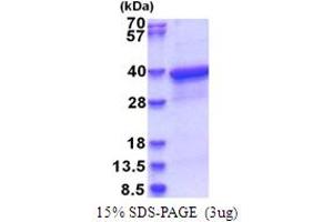 SDS-PAGE (SDS) image for HLA Class I alpha F (HLAF) (AA 22-305) protein (His tag) (ABIN6387446)