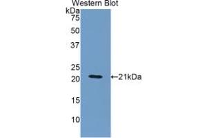 WB of Protein Standard: different control antibodies against Highly purified E. (ORM1 Kit ELISA)