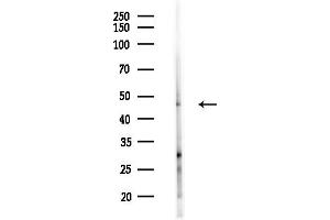 anti-Inositol Hexakisphosphate Kinase 2 (IP6K2) (Internal Region) antibody