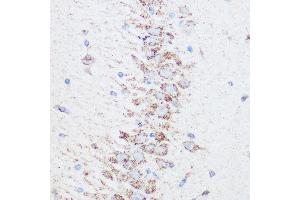 Immunohistochemistry of paraffin-embedded rat brain using SIRT4 Rabbit pAb (ABIN6129330, ABIN6147796, ABIN6147797 and ABIN6223494) at dilution of 1:100 (40x lens). (SIRT4 anticorps  (AA 29-260))