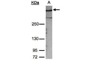 WB Image Sample (30μg whole cell lysate) A:HeLa S3, 5% SDS PAGE antibody diluted at 1:1000 (AKAP12 anticorps  (C-Term))