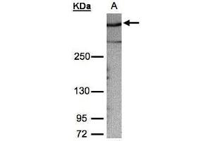WB Image Sample (30μg whole cell lysate) A:HeLa S3, 5% SDS PAGE antibody diluted at 1:1000 (AKAP12 anticorps  (C-Term))
