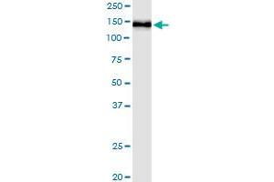 Immunoprecipitation of PHC1 transfected lysate using anti-PHC1 MaxPab rabbit polyclonal antibody and Protein A Magnetic Bead , and immunoblotted with PHC1 purified MaxPab mouse polyclonal antibody (B01P) .