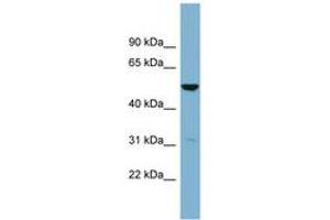 Image no. 1 for anti-Serine Dehydratase-Like (SDSL) (C-Term) antibody (ABIN6743388)