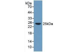 Figure. (CRP anticorps  (AA 17-224))