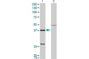 Western Blot analysis of CTSK expression in transfected 293T cell line by CTSK monoclonal antibody (M01), clone 2F1.