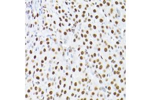 Immunohistochemistry of paraffin-embedded rat ovary using K/K/TRIM28 Rabbit pAb  at dilution of 1:200 (40x lens). (KAP1 anticorps  (AA 576-835))