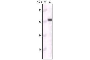 Western blot analysis using CK5 mouse mAb against truncated CK5 recombinant protein (Cytokeratin 5 anticorps)