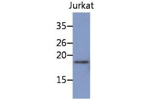 The cell lysate of Jurkat (30ug) were resolved by SDS-PAGE, transferred to PVDF membrane and probed with anti-human NBL1 antibody (1:1000). (NBL1 anticorps)