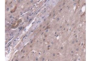 Detection of PC in Human Liver Tissue using Polyclonal Antibody to Pyruvate Carboxylase (PC)