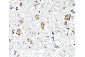 Immunohistochemistry of paraffin-embedded Rat brain using RBP2 Polyclonal Antibody at dilution of 1:100 (40x lens).