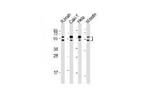All lanes : Anti-CDKL3 Antibody (N-Term) at 1:2000 dilution Lane 1: rat brain lysates Lane 2: Caki-1 whole cell lysates Lane 3: Hela whole cell lysates Lane 4: mouse testis lysates Lysates/proteins at 20 μg per lane. (CDKL3 anticorps  (AA 2-34))