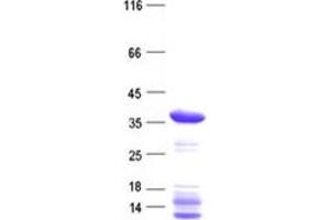 Validation with Western Blot (CDKL4 Protein (His tag))