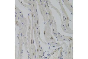 Immunohistochemistry of paraffin-embedded mouse heart using NASP Antibody (ABIN5975448) at dilution of 1/100 (40x lens). (NASP anticorps)