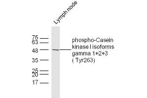 anti-CSNK1G1, CSNK1G2, CSNK1G3 (pTyr263) antibody