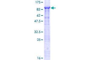 Image no. 1 for Prolyl 4-Hydroxylase, Transmembrane (Endoplasmic Reticulum) (P4HTM) (AA 1-563) protein (GST tag) (ABIN1313840)