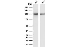 Western Blot Analysis of human HeLa and MCF-7 cell lysate with ENAH / MENA Mouse Monoclonal Antibody (ENAH/1988). (ENAH anticorps  (AA 485-589))