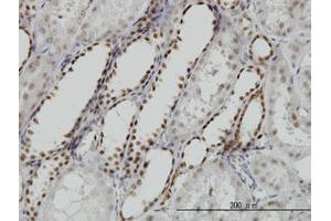 Image no. 5 for anti-Decapping Enzyme, Scavenger (DCPS) (AA 1-338) antibody (ABIN599227) (DCPS anticorps  (AA 1-338))