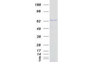 Validation with Western Blot