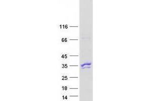Validation with Western Blot