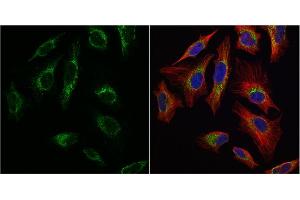 ICC/IF Image mtTFA antibody detects mtTFA protein at mitochondria by immunofluorescent analysis.